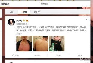 樊昊仑爆料赫子铭视频,真相背后引人深思 第2张 樊昊仑爆料赫子铭视频,真相背后引人深思 第2张